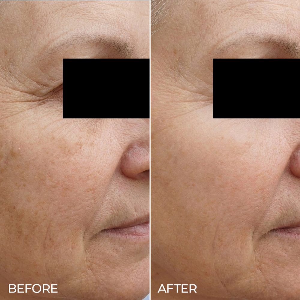 RETI AGE 5 Serum Sesderma