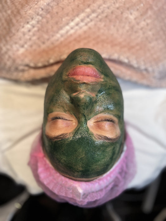 ¿Por qué tu acné no mejora aunque uses buenos productos?